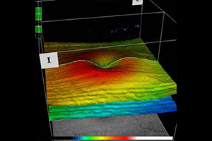 Optische Kohärenztomographie – Augenärztliche Gemeinschaftspraxis | Dr. Heuring, Dr. Jung & Kollegen